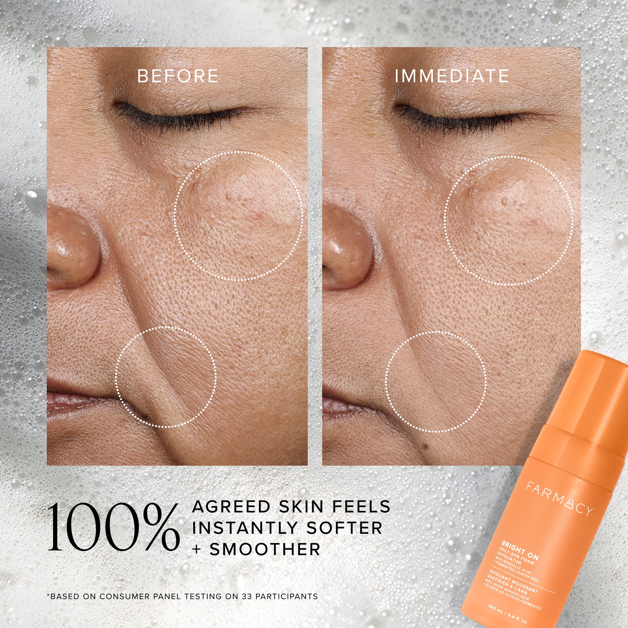 Before and after comparison of skin texture with a Farmacy product on a gray background
