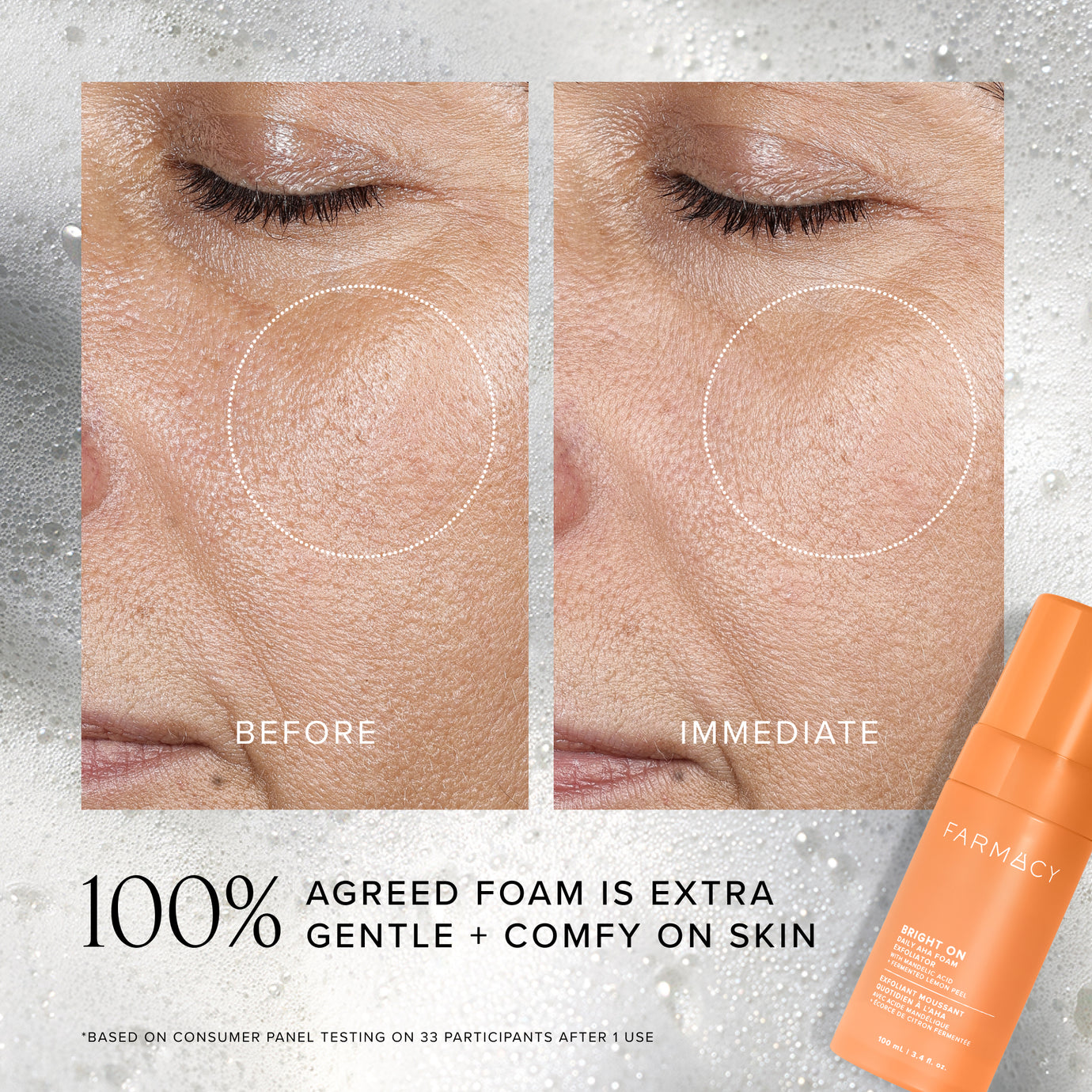 Before and after comparison of skin with a Farmacy product on a gray background